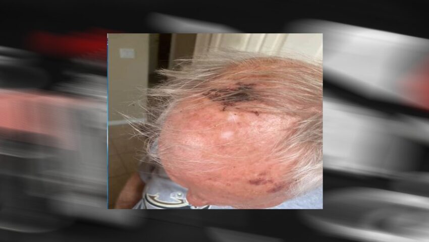 77-letni weteran został pobity bo popierał Trumpa i policję