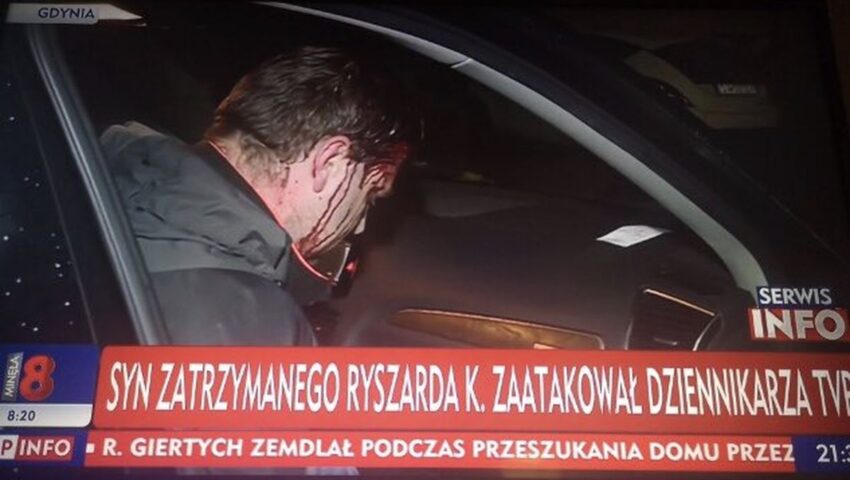 Przerażające! Dziennikarz TVP zaatakowany i pobity pod domem Ryszarda K.